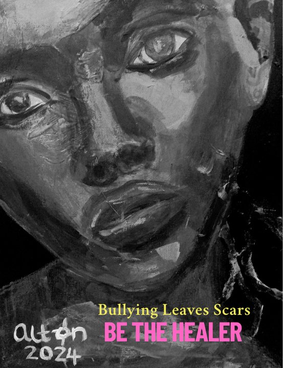 scars